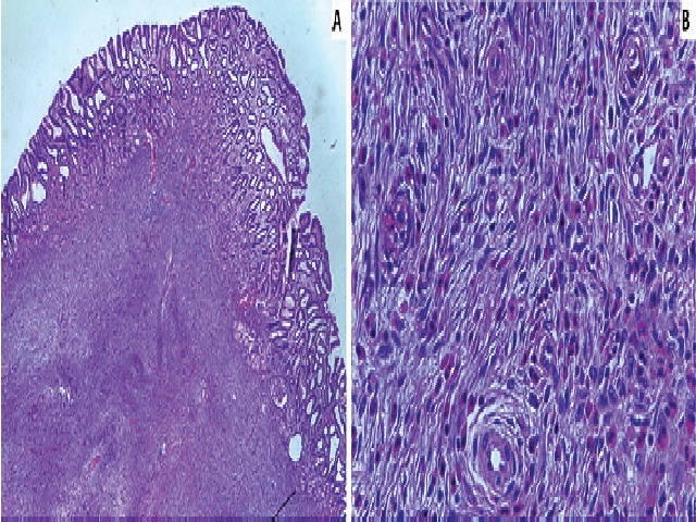 Histopathological images of the lesion