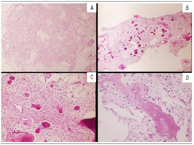 Histopathological characteristics