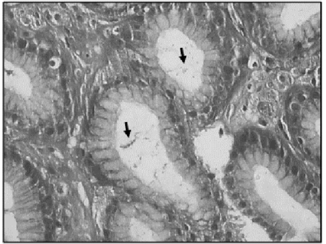 Histological section image of the gastric antrum (400× magnification), stained by Giemsa’s technique, showing the presence of H. pylori The arrow indicates the presence of H. pylori.