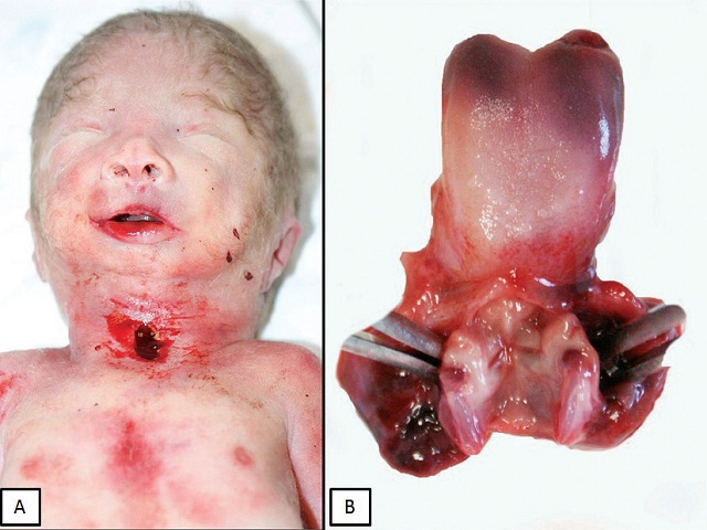 Ectoscopy and cervical viscera