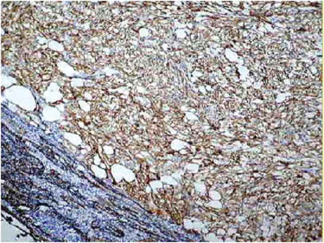 Immunostaining for anti-smooth muscle actin antibodies (10× objective lens)