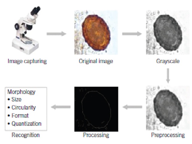 Flow chart showing the steps of parasite eggs identification using Parasitology software DSS