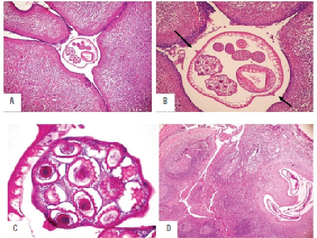 Histological sections of the lymph node and the tonsil