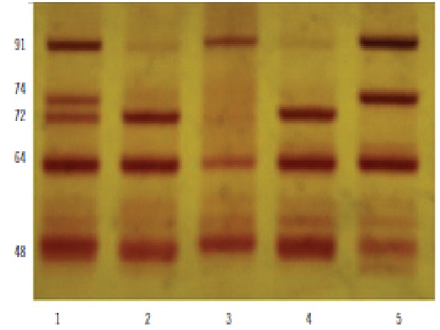 Polyacrylamide ApoE gel electrophoresis