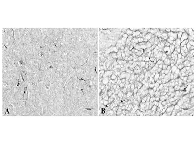 Microscopic appearance of freezing artifact A) putamen showing unchanged neuropil, with preserved cells and fibers morphology, in brain tissue frozen at optimal speed; B) freezing artifact in putamen, with cavities formation of extracellular ice crystals and tissue displacement caused by low speed freezing. 100x magnification, NADPHd staining. NADPHd: nicotinamide adenine dinucleotide phosphate diaphorase.
