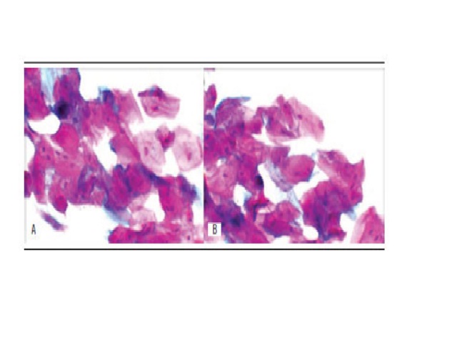 Comparative evaluation of the quality of papanicolaou staining at different intervals of fixation times using 96% ethyl alcohol