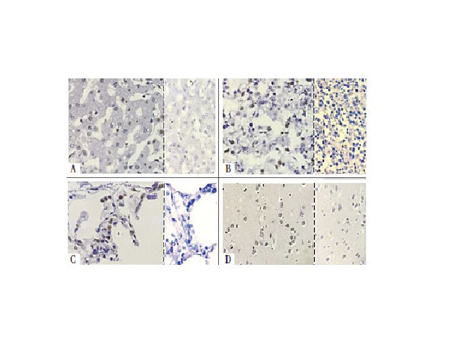 Reações CISH para detecção de DNA. Fotomicrografia de reação CISH para DNA A) fígado; B) baço; C) pulmão; D) cérebro; ampliação 40×. É possível observar o precipitado marrom no núcleo celular resultante da reação enzimática do DAB com a peroxidase do complexo anticorpo ligado ao híbrido formado entre a sequência-alvo e a sonda nas reações com a sonda positiva (direita) em comparação com as reações com a sonda negativa (esquerda)