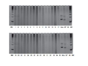 Electrophoresis in 8% polyacrylamide gel stained with silver nitrate. HPV amplification (142 bp) HPV: human papillomavirus; MW: 100 bp DNA ladder; HeLa: DNA from HPV 18-infected cervical carcinoma cell line; CO2: condyloma DNA; NO: no DNA control; DNA: deoxyribonucleic acid; MW: molecular weight.