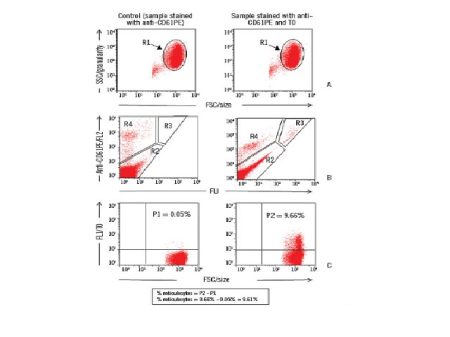 Strategy of analysis for reticulocyte count by FC/TO and CD61PE A) selection of the population of interest, R1, based on morphometric aspects for the construction of graph B (FL1 × anti-CD61PE/FL2); B) identification of the homogeneous population, R2, and possible interferents - R3 and R4; C) quantification of the percentage of positive cells in the upper right quadrant (stained with TO) present in the R2 region - graph drawn with the combination of gates in R1 and R2 regions. FC/TO: method of reticulocyte count by flow cytometry, using thiazole orange; SSC: side scatter; FSC: forward scatter.