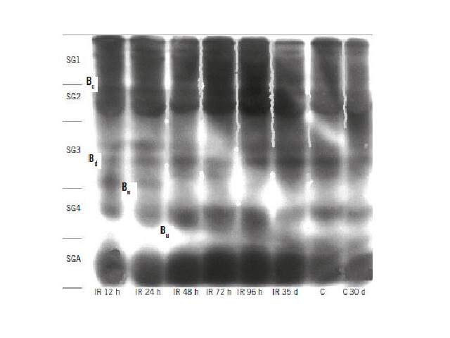 Electrophoretic profile at 10%, blood serum in cardiac territory of IR and C on days 0 and 30, in kinetics of 12, 24, 48, 72, and 96 h, and 35 days, identified in SG1, SG2, SG3, SG4, and SGA IR: irradiated animals; C: control group; SG1: subgroup 1; SG2: subgroup 2; SG3: subgroup 3; SG4: subgroup 4; SGA: subgroup albumin.