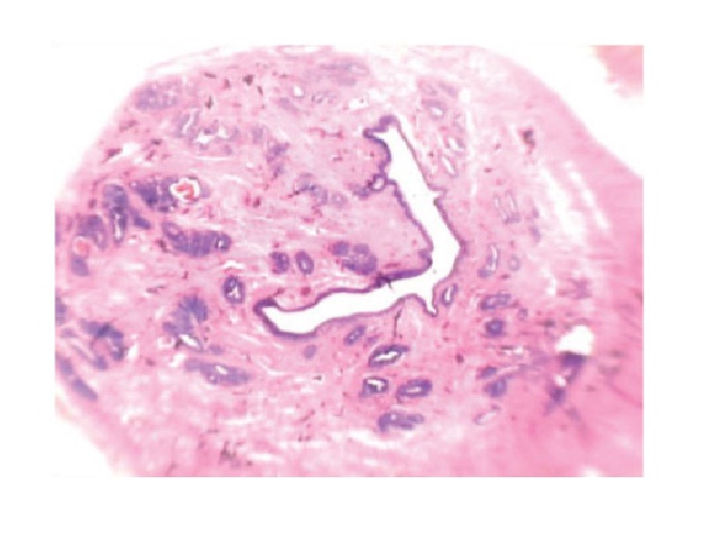 Histological panoramic view of prostate tissue