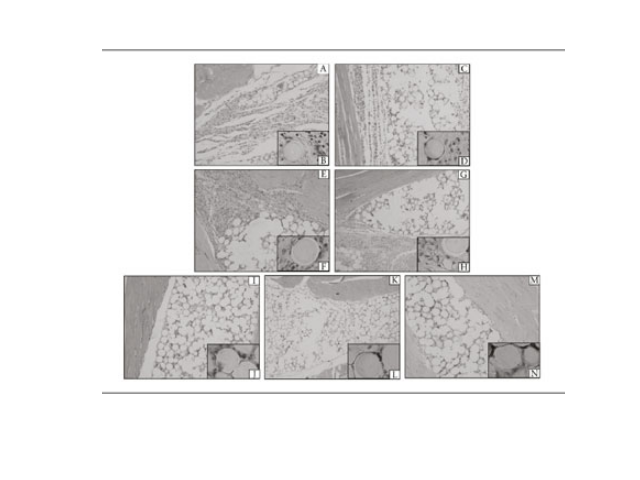 Photomicrography, stained with HE, of the skeletal musculature of BALB/c mice after implantation of Linnea Safe