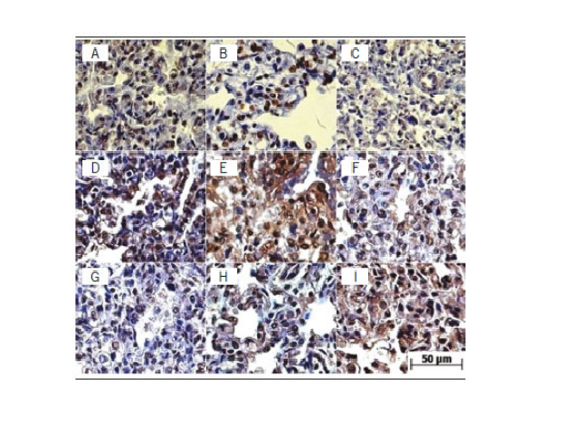 Immunohistochemical reaction