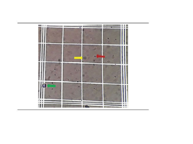 Validation of a new method for estimating low platelet counts: G&S method