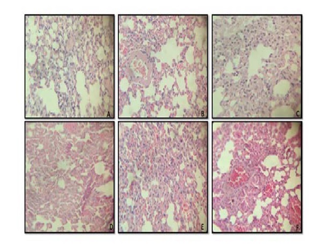 Lung histopathological changes in Swiss mice exposed to narghile smoke