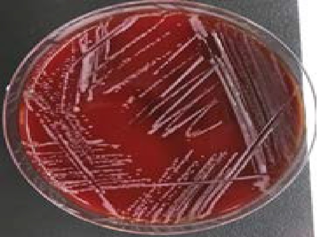 Bacterial Culture: Roseomonas spp